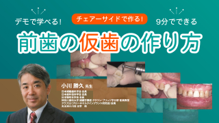 チェアサイドで作る！『前歯の仮歯の作り方』の画像です。
