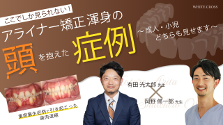 ここでしか見られない！アライナー矯正渾身の頭を抱えた症例〜成人・小児どちらも見せます〜の画像です。