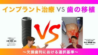 インプラント治療VS歯の移植の画像です。