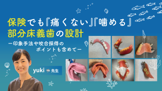 保険でも『痛くない』『噛める』部分床義歯の設計〜印象手法や咬合採得のポイントも含めて〜の画像です。