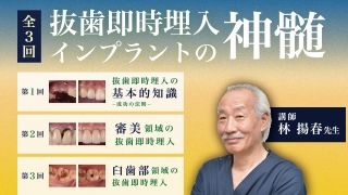 抜歯即時埋入インプラントの神髄の画像です。