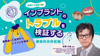 好評につき第三弾！インプラントのトラブルを検証する〜審美的合併症編〜の画像です。