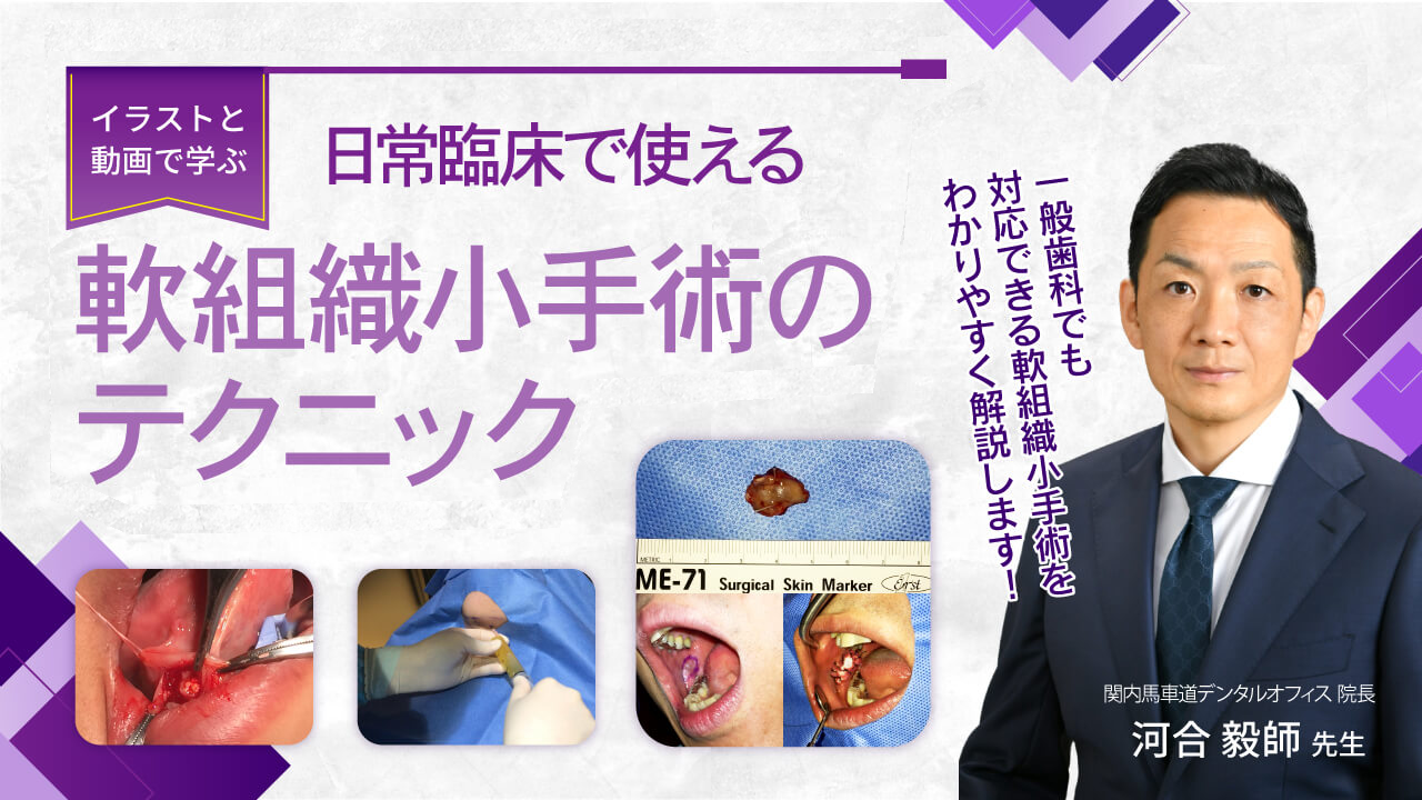 〜イラストと動画で学ぶ〜日常臨床で使える軟組織小手術のテクニックの画像です。