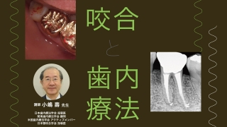 咬合と歯内療法の画像です。