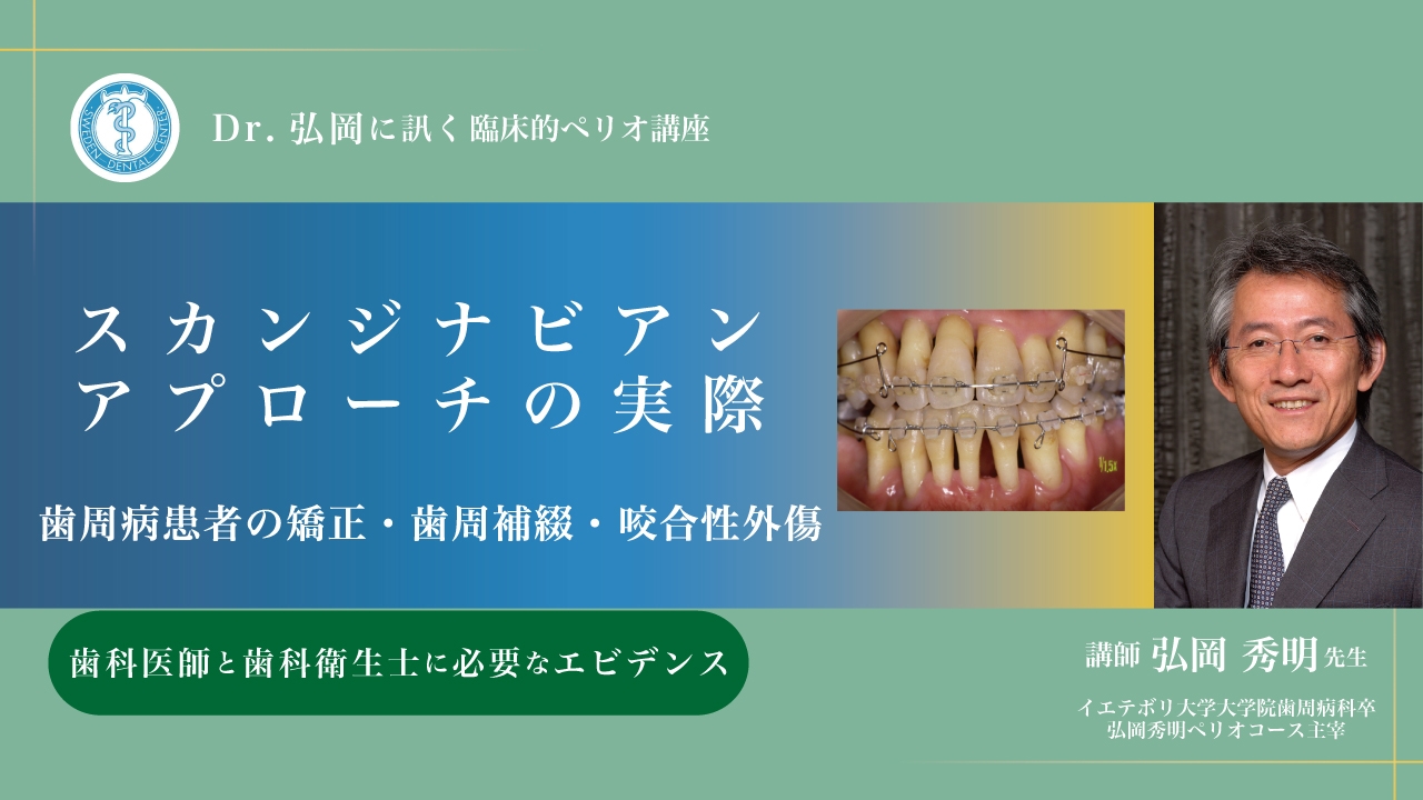 Dr.弘岡に訊く臨床的ペリオ講座 スカンジナビアンアプローチの実際〜歯