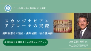Dr.弘岡に訊く臨床的ペリオ講座 スカンジナビアンアプローチの実際〜歯