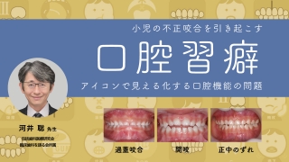 小児の不正咬合を引き起こす口腔習癖　アイコンで見える化する口腔機能の問題の画像です。