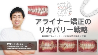 裁断済み　萌出障害 : 先天欠如,歯胚位置異常,萌出遅延,過剰歯,捻転歯 萌出障害～先天欠如、歯胚位置異常、萌出遅延、過剰歯、捻転歯