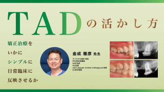 成長・発達期における不正咬合の早期治療 316g3Wtv3RL.jpg_BO30,255,255,