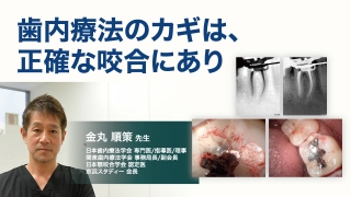 歯内療法のカギは、正確な咬合にありの画像です。