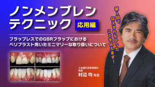 ノンメンブレンテクニック 応用編の画像です。