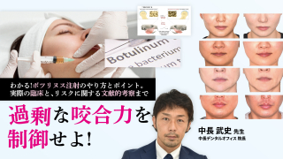 過剰な咬合力を制御せよ！〜わかる！ボツリヌス注射のやり方とポイント。実際の臨床と、リスクに関する文献的考察まで〜の画像です。