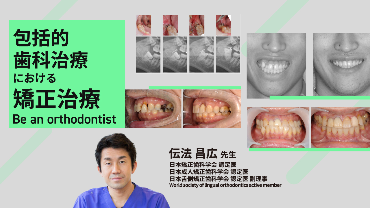 包括的歯科治療における矯正治療〜Be an orthodontist〜の画像です。