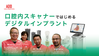 口腔内スキャナーではじめるデジタルインプラントの画像です。