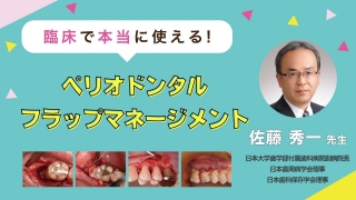 臨床で本当に使える！ペリオドンタルフラップマネージメントの画像です。