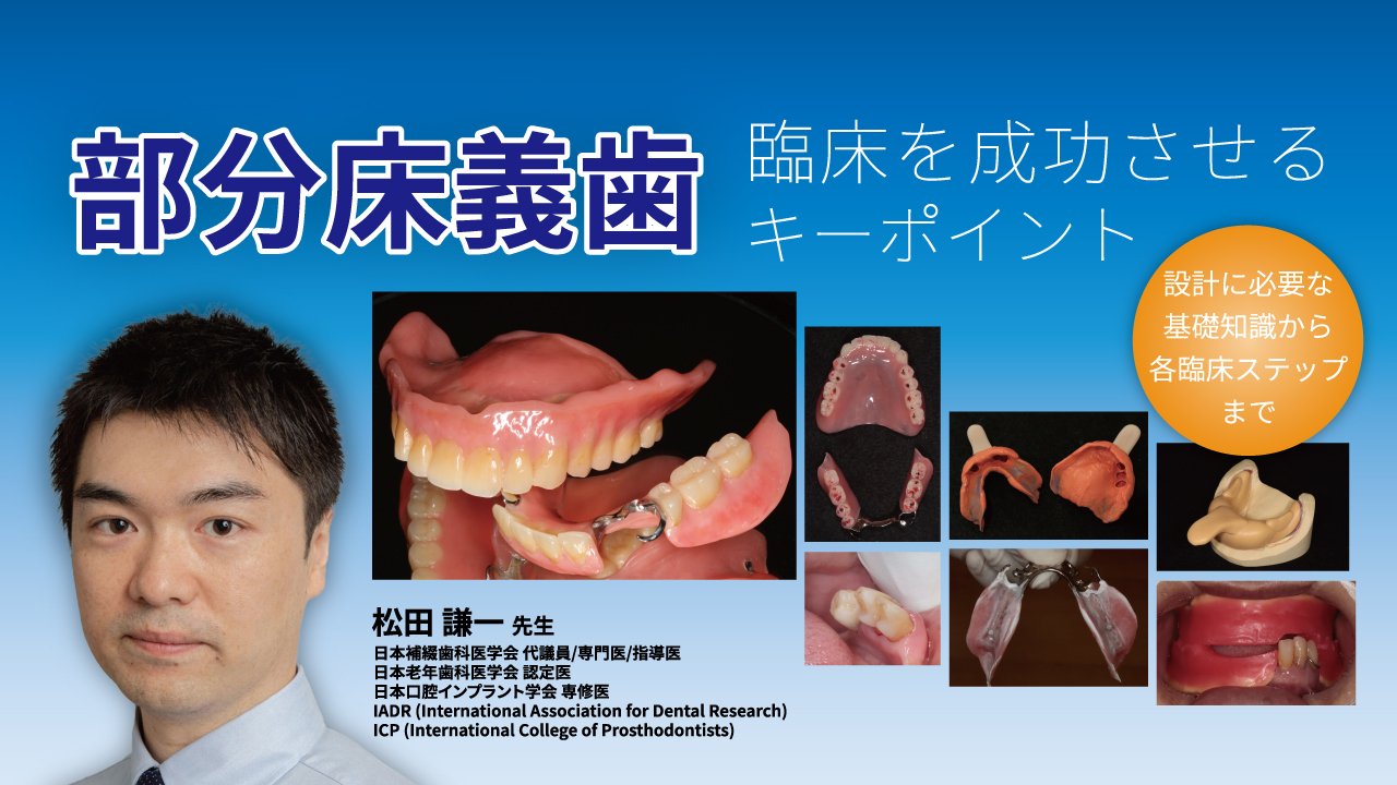 部分床義歯臨床を成功させるキーポイント〜設計に必要な基礎知識から各 