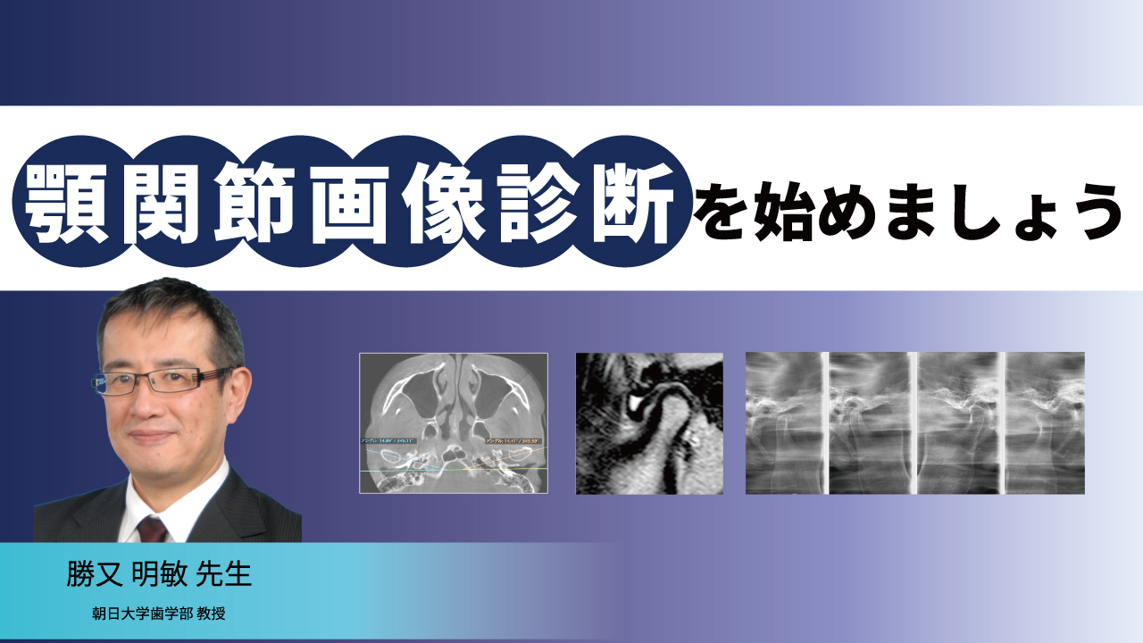 顎関節画像診断を始めましょう | WHITE CROSS
