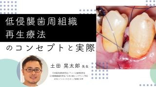 低侵襲歯周組織再生療法のコンセプトと実際の画像です。