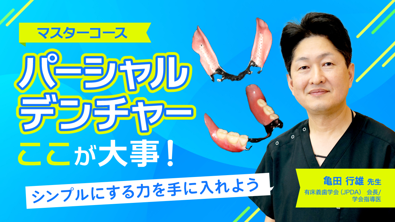 【マスターコース】パーシャルデンチャーここが大事！の画像です。
