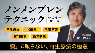 ノンメンブレンテクニック マスターコース〜再生療法・GBR・乳頭再建・材料解説・術式解説〜の画像です。