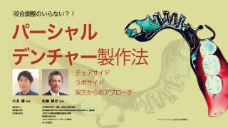 咬合調整のいらない？！パーシャルデンチャー製作法〜チェアサイド・ラボサイド双方からのアプローチ〜の画像です。