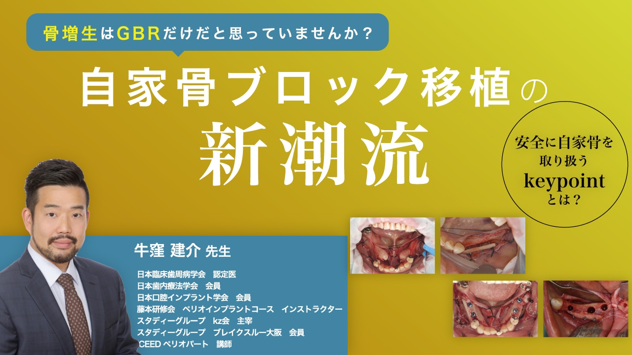 自家骨ブロック移植の新潮流 〜安全に自家骨を取り扱うkeypointとは