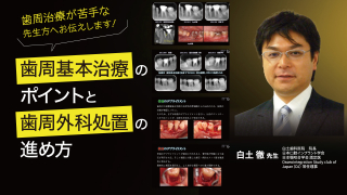 Dr.弘岡に訊く臨床的ペリオ講座 スカンジナビアンアプローチの実際