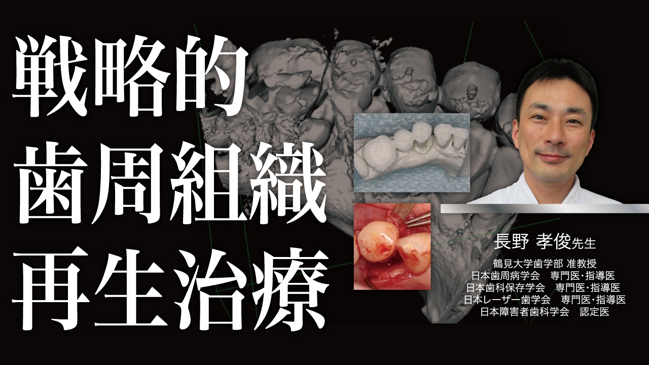 戦略的歯周組織再生治療〜CTデータと抗菌薬を応用する〜の画像です。