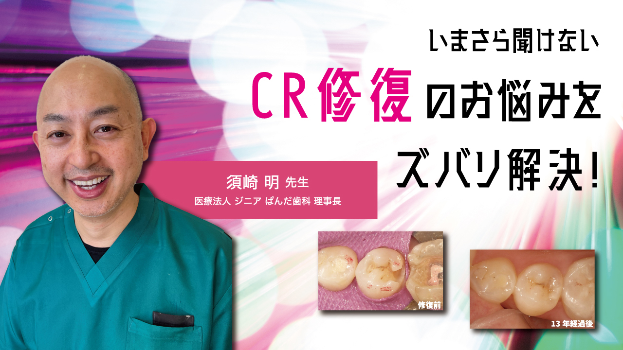 いまさら聞けないCR修復のお悩みをズバリ解決！の画像です。