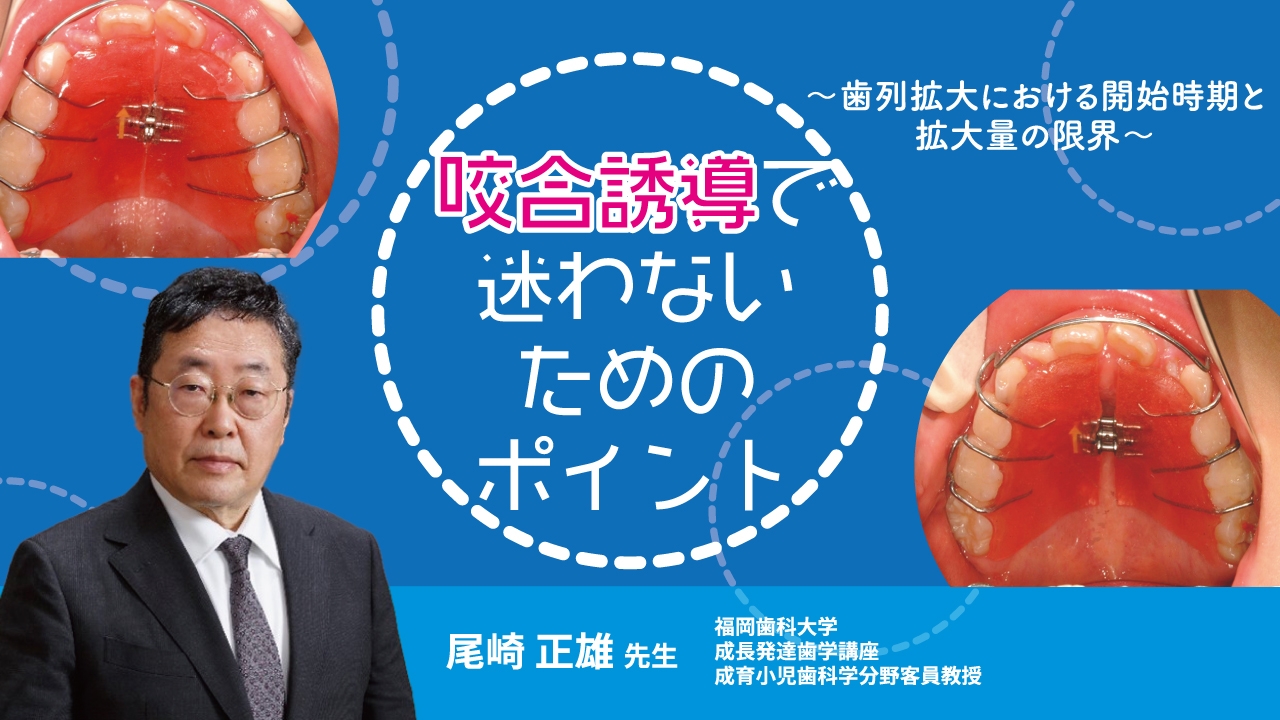 咬合誘導で迷わないためのポイント〜歯列拡大における開始時期と拡大量の限界〜の画像です。