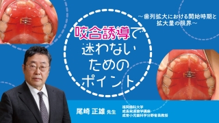 咬合誘導で迷わないためのポイント〜歯列拡大における開始時期と拡大量の限界〜の画像です。