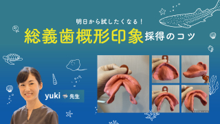 明日から試したくなる！総義歯概形印象採得のコツの画像です。