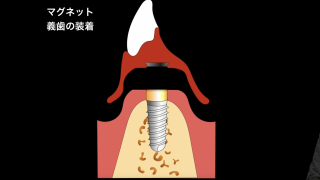 【第3回】臨床実践編の画像です。