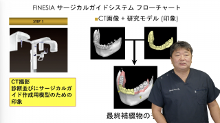 ▲01)【同梱不可】Perfect Sinus Lift/上顎洞底挙上術のすべて/小林文夫/高橋常男/ゼニス出版/2010年/歯科学/口腔外科/インプラント/A Amazon.co.jp: Perfect sinus lift: 上顎洞底挙上術のすべて