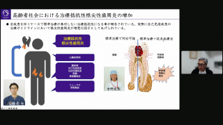 根尖性歯周炎の謎〜顎骨の炎症と破壊〜の画像です。