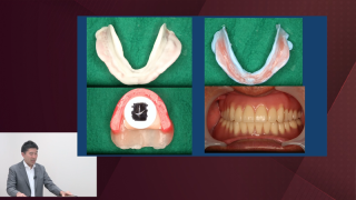Dr.石幡プレゼンツ 「GP専用-欠損補綴学-」 臨床医の為の最速
