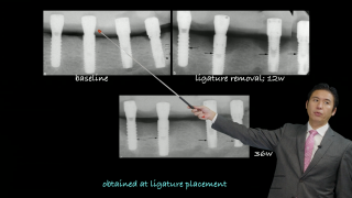 これを知らなきゃインプラントは絶対やらないでの画像です。
