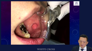 〜イラストと動画で学ぶ〜日常臨床で使える軟組織小手術のテクニックの画像です。