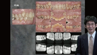 歯科医院全体で学ぶ 最新のカリオロジー＆ペリオドントロジー〜5つの視点〜の画像です。