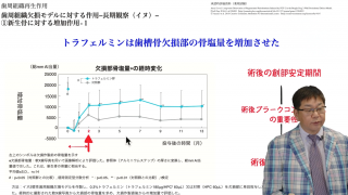 【第3回】歯周外科治療〜SPTへ〜の画像です。