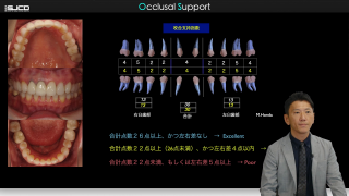 必ずできる！咬合再構成〜咬合採得の本質に迫る〜の画像です。
