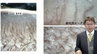 第3回　歯周組織の理解の画像です。