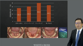「力」を診る〜歯を失わないために〜の画像です。