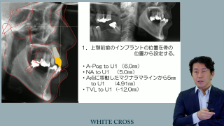 包括的歯科治療における矯正治療〜Be an orthodontist〜の画像です。