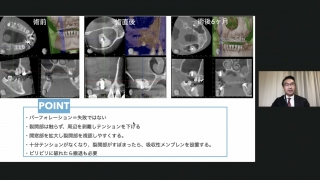 【第3回】Flap Design Album シンポジウム（第2回）の画像です。