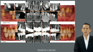 歯科衛生士と若手歯科医師におくる歯周疾患とインプラント周囲疾患のはなしの画像です。