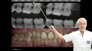 もう迷わない！最善な歯科治療のためのイエテボリ診断学の画像です。