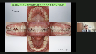 TADの活かし方〜矯正治療をいかにシンプルに日常臨床に反映させるか