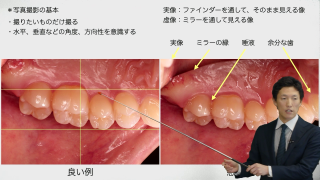 スタッフ全員で口腔内写真撮影の質を高めよう！〜撮影に必要なノウハウを伝授します〜の画像です。