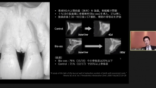【第1回】Flap Design Album このシチュエーションに この切開の画像です。